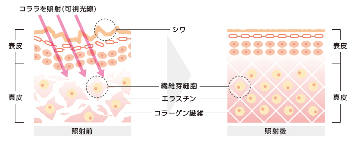 コララ「オーエムシー株式会社」